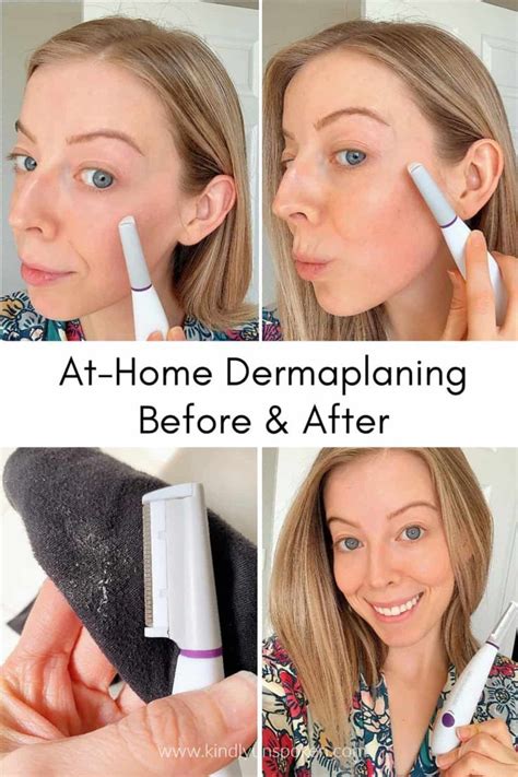 best dermaplaning tool for at home|best dermaplaning near me.